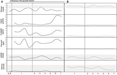 Insulinoma in pediatric tuberous sclerosis complex: a case report